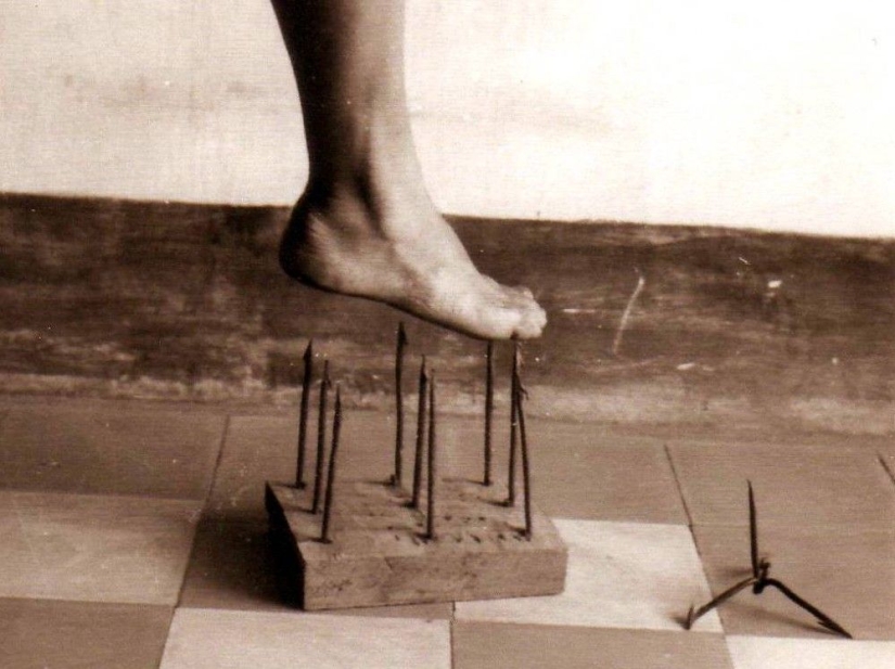 10 strange medical conditions that almost no one has heard of 10 strange medical conditions that almost no one has heard of