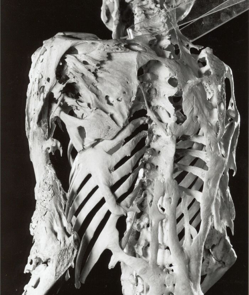 10 strange medical conditions that almost no one has heard of 10 strange medical conditions that almost no one has heard of