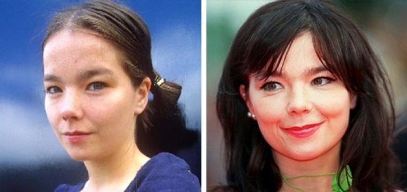 11 celebridades que demostraron que la belleza puede ser diferente