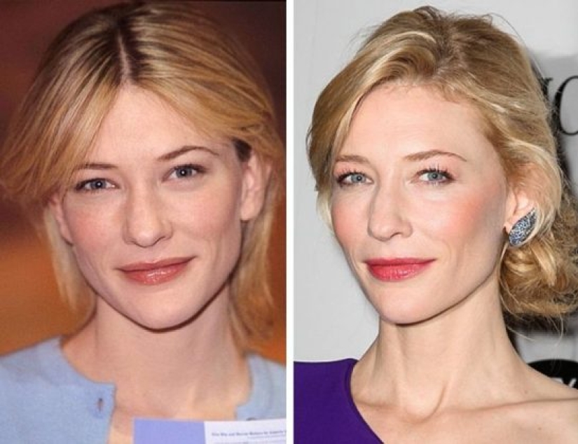 11 celebridades que demostraron que la belleza puede ser diferente