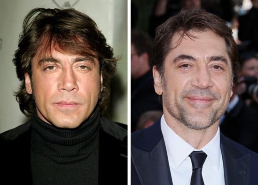 11 celebridades que demostraron que la belleza puede ser diferente