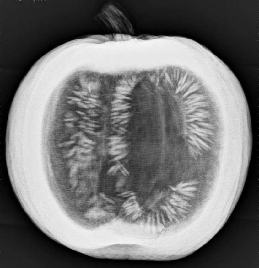 14 cosas que la naturaleza no puede mostrar, pero una radiografía puede mostrar