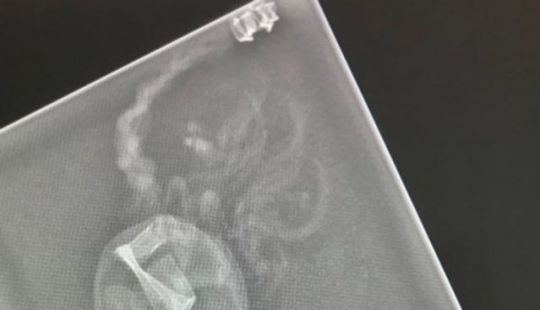 14 Things Nature Can't Show, But An X-Ray Can Show 14 Things Nature Can't Show, But An X-Ray Can Show