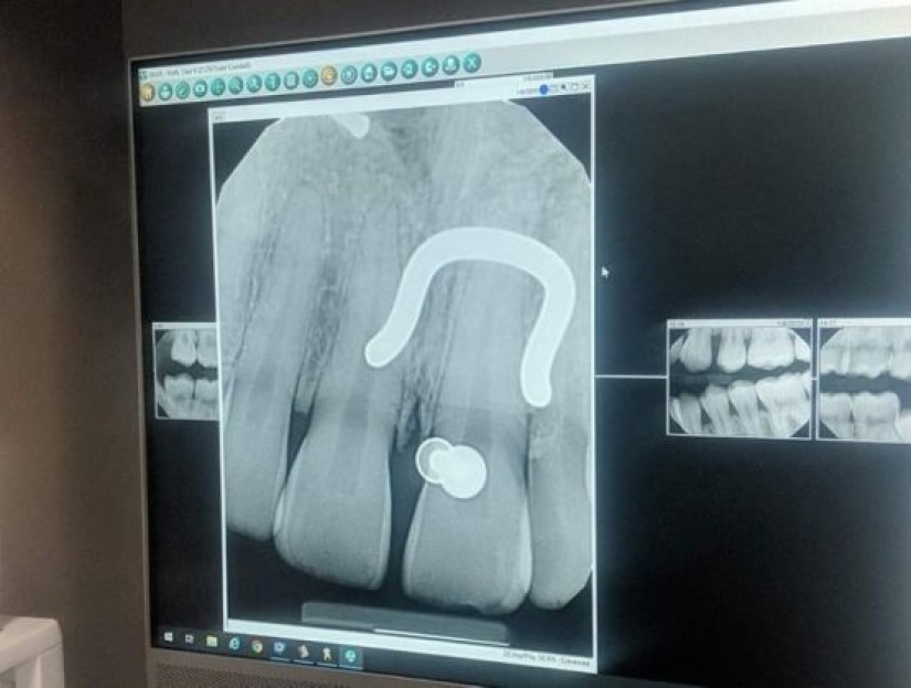 14 Things Nature Can't Show, But An X-Ray Can Show