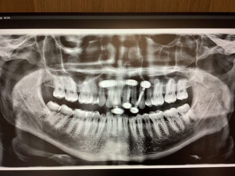 14 Things Nature Can't Show, But An X-Ray Can Show