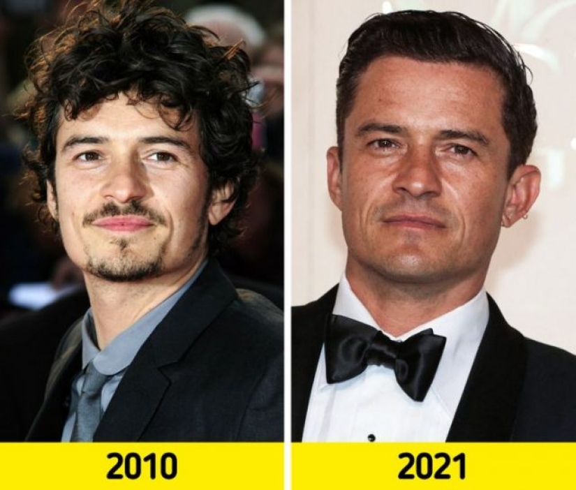 16 celebrities who have changed beyond recognition over the past decade