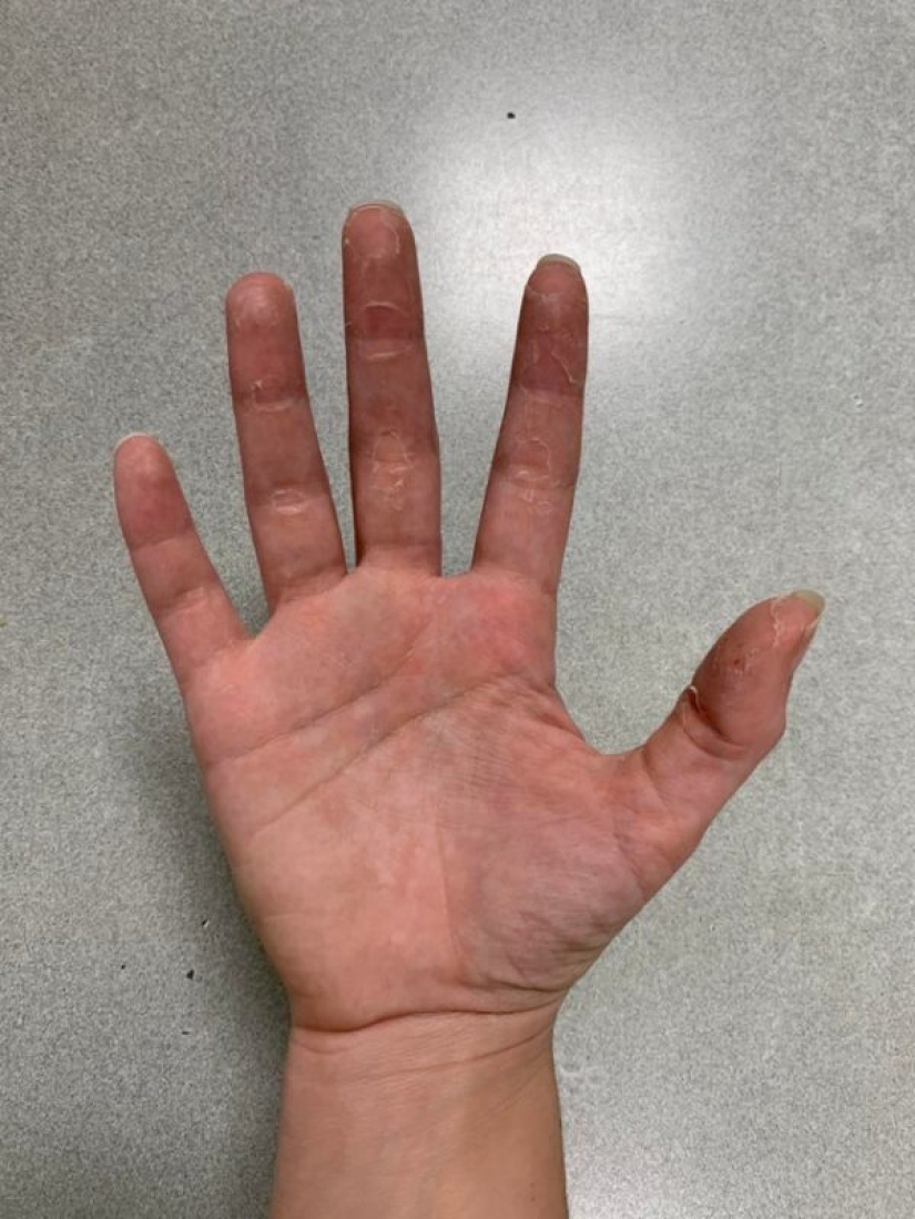 20 people whose quarantine is definitely worse than yours 20 people whose quarantine is definitely worse than yours