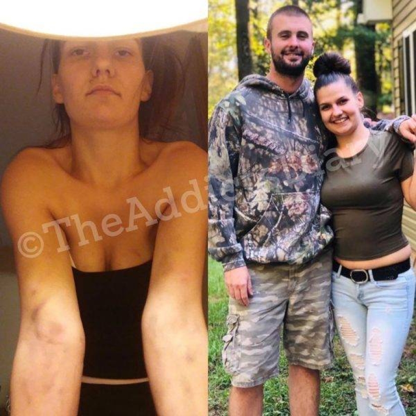 20 photos of people "before and after" how they managed to cope with addiction 20 photos of people "before and after" how they managed to cope with addiction