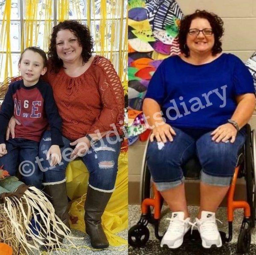 20 photos of people "before and after" how they managed to cope with addiction 20 photos of people "before and after" how they managed to cope with addiction