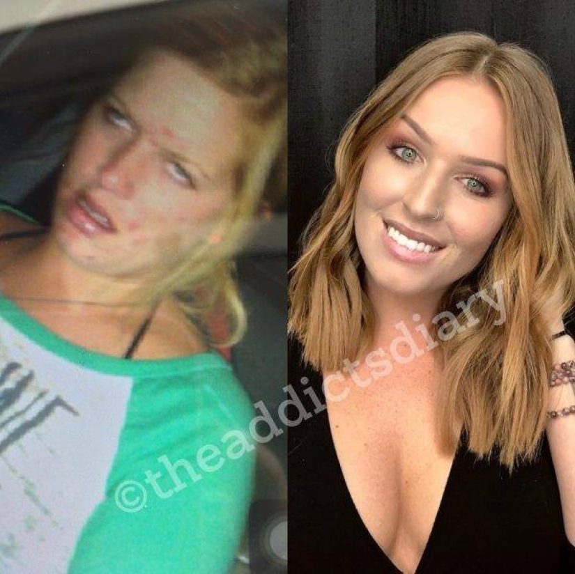 20 photos of people "before and after" how they managed to cope with addiction 20 photos of people "before and after" how they managed to cope with addiction