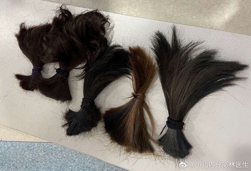 25 fotos sobre la vida cotidiana del personal médico en Wuhan infectado con coronavirus