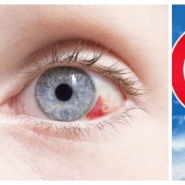 5 preguntas principales sobre Omicron en niños: los médicos responden