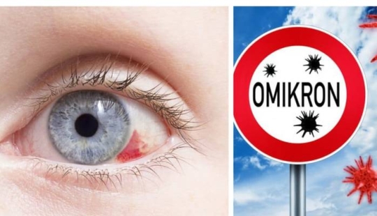 5 preguntas principales sobre Omicron en niños: los médicos responden