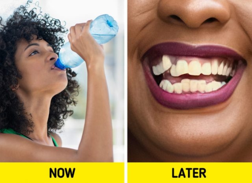 6 razones por las que tus dientes pueden estar manchados