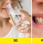 6 Reasons Your Teeth May Be Staining