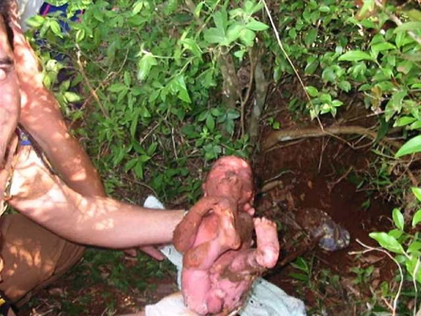 7 incredible stories of infant survival