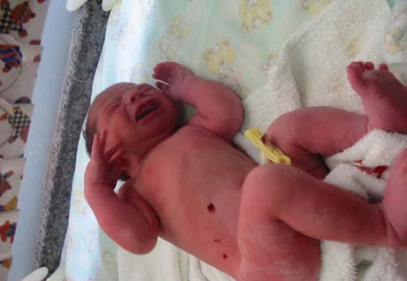 7 incredible stories of infant survival