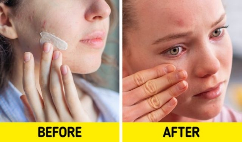 7 productos para el cuidado de la piel que pueden dañar tu piel 7 productos para el cuidado de la piel que pueden dañar tu piel