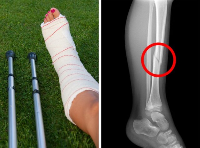 7 signs you need to stop drinking milk 7 signs you need to stop drinking milk