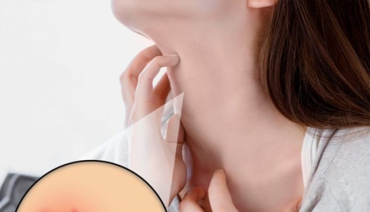 7 signs you need to stop drinking milk