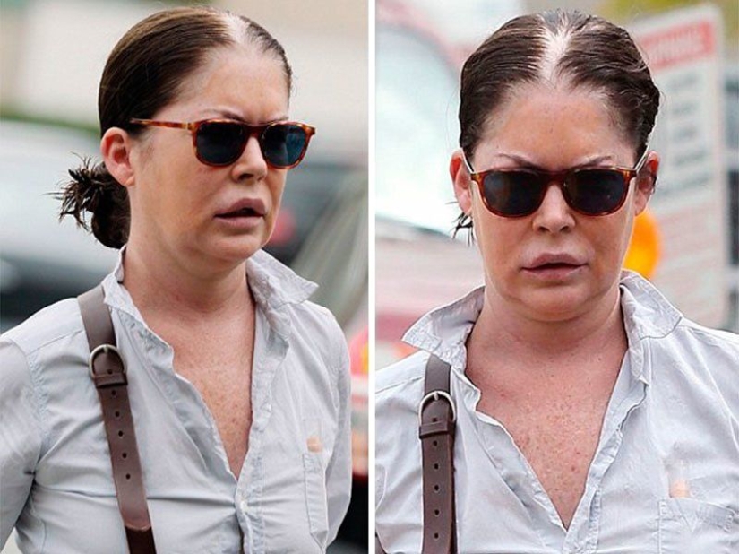 8 movie stars who lost their careers after plastic surgery 8 movie stars who lost their careers after plastic surgery