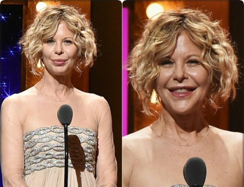 8 movie stars who lost their careers after plastic surgery 8 movie stars who lost their careers after plastic surgery