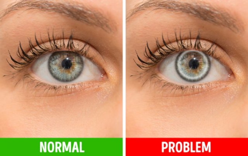 8 señales de que tu cuerpo te está diciendo que algo anda mal