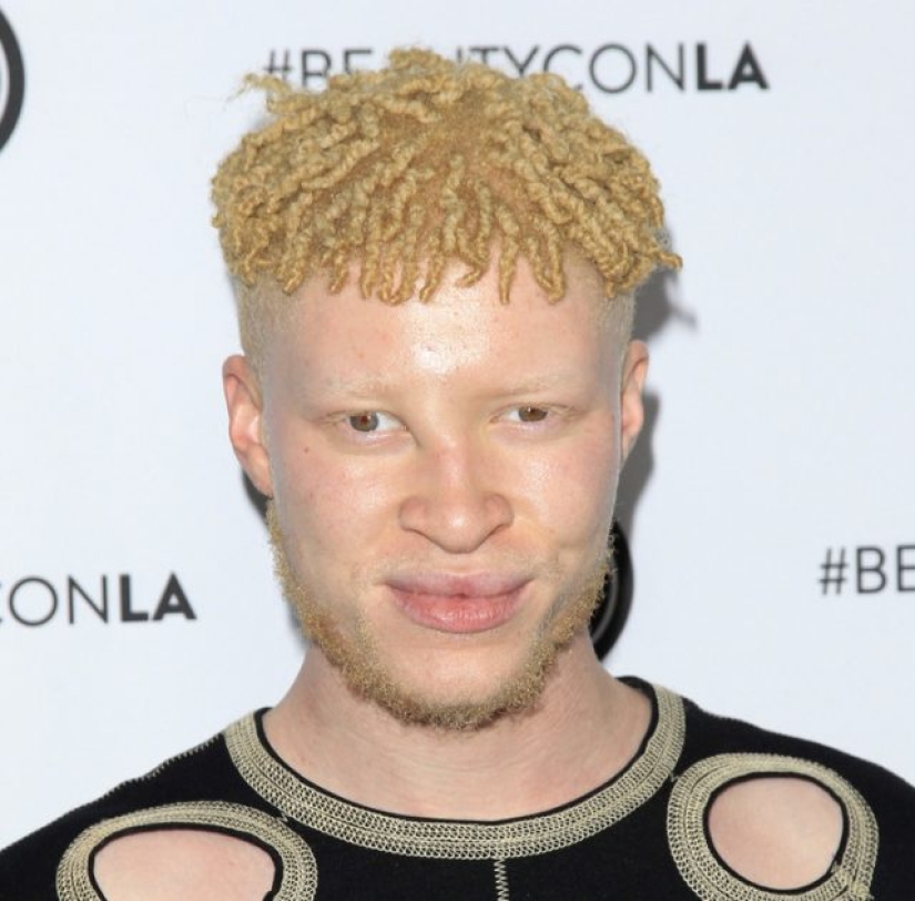 9 celebridades con partes del cuerpo únicas