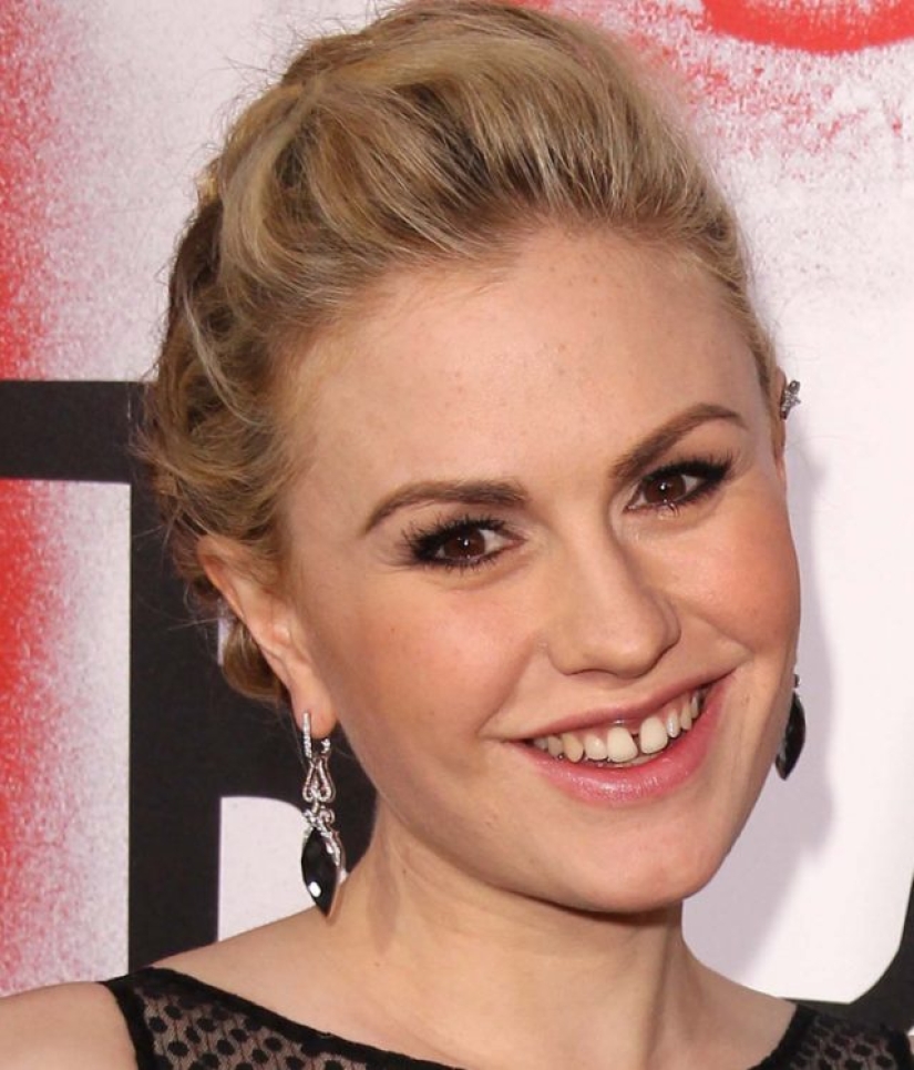 9 celebridades con partes del cuerpo únicas