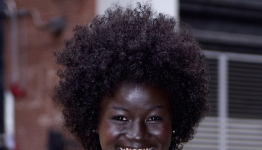 9 celebrities with unique body parts