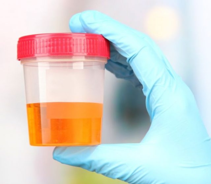 9 Crazy Things Used As Currency Around The World 9 Crazy Things Used As Currency Around The World