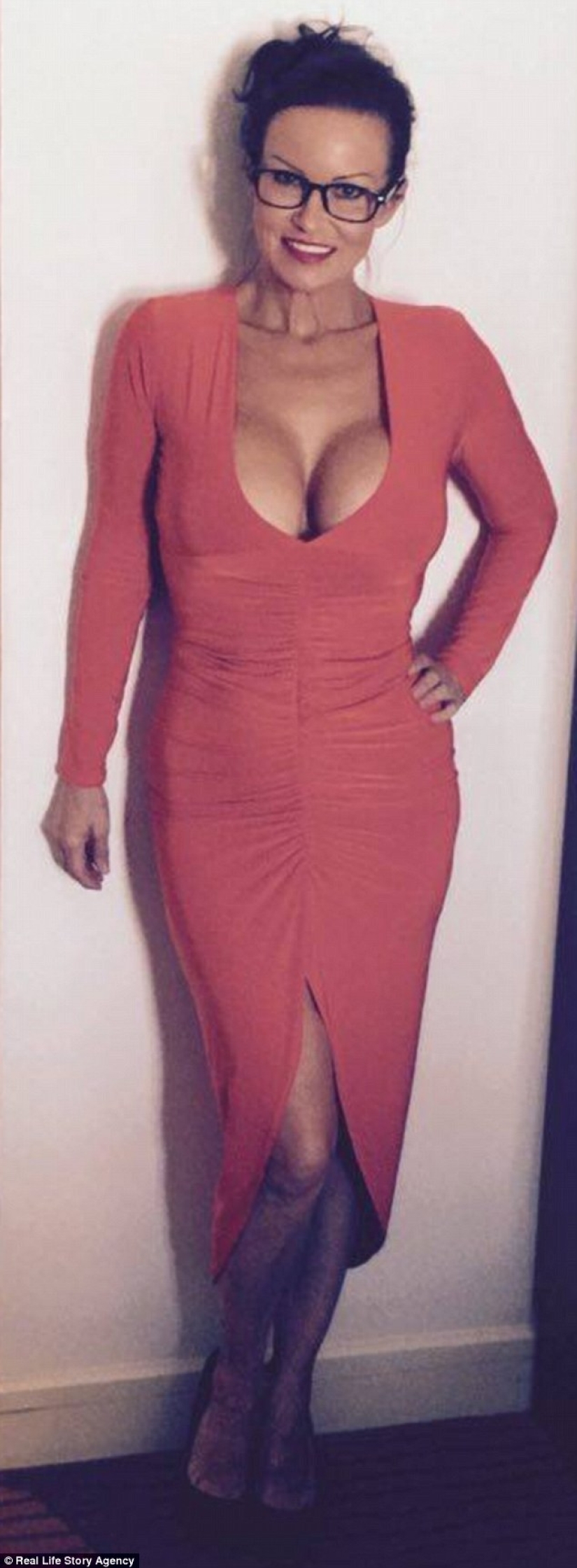 A 50-year-old plastic fan boasted that she looks 30 years old A 50-year-old plastic fan boasted that she looks 30 years old