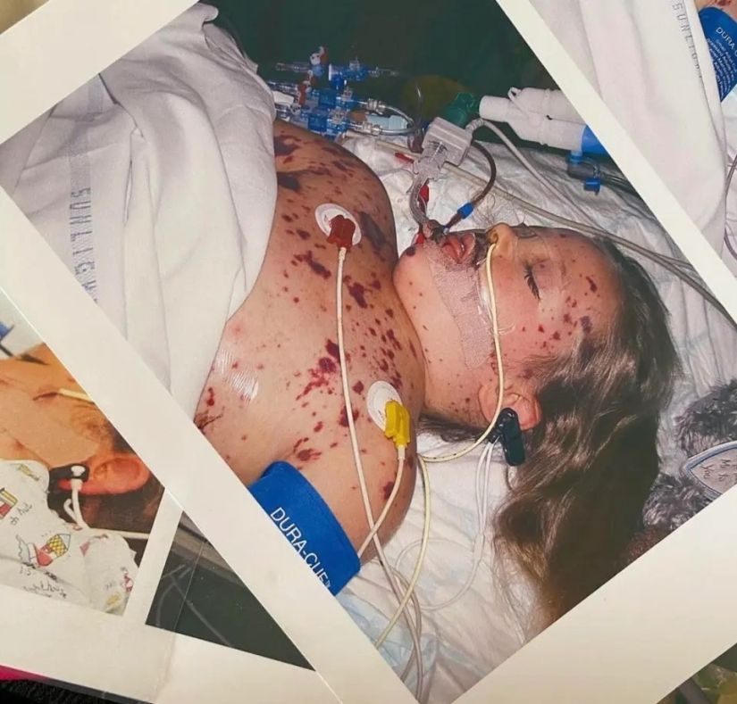 A British woman who had all her limbs amputated conducts makeup workshops