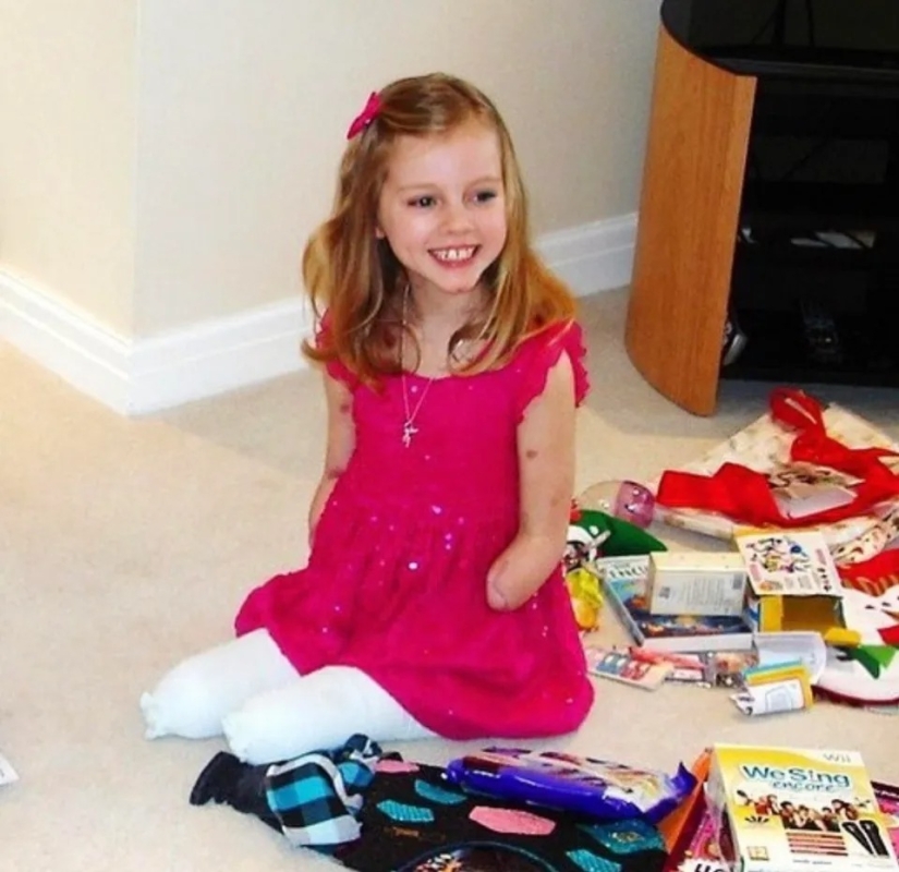 A British woman who had all her limbs amputated conducts makeup workshops