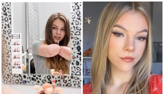 A British woman who had all her limbs amputated conducts makeup workshops A British woman who had all her limbs amputated conducts makeup workshops