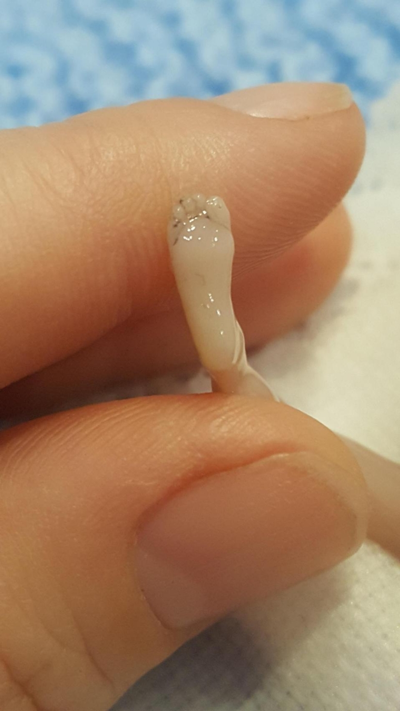 A child or a biomaterial? An American woman has published a photo of her stillborn son