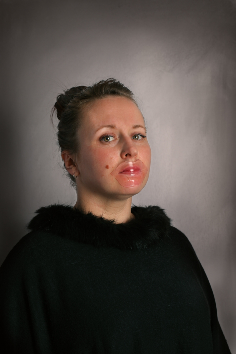 A clothespin on the nose and duck lips: what women are ready for for the sake of beauty and youth A clothespin on the nose and duck lips: what women are ready for for the sake of beauty and youth