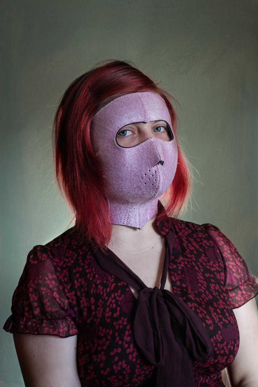 A clothespin on the nose and duck lips: what women are ready for for the sake of beauty and youth A clothespin on the nose and duck lips: what women are ready for for the sake of beauty and youth