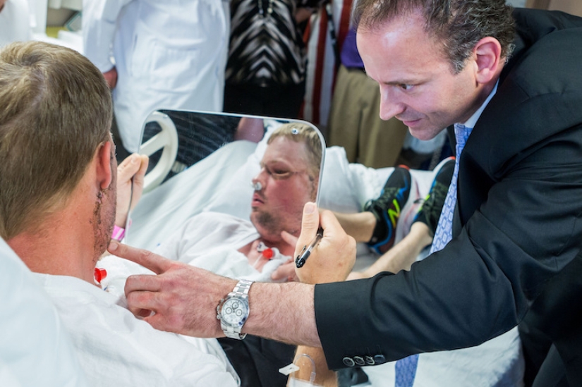 A failed suicide had his face transplanted, and a new life began for him