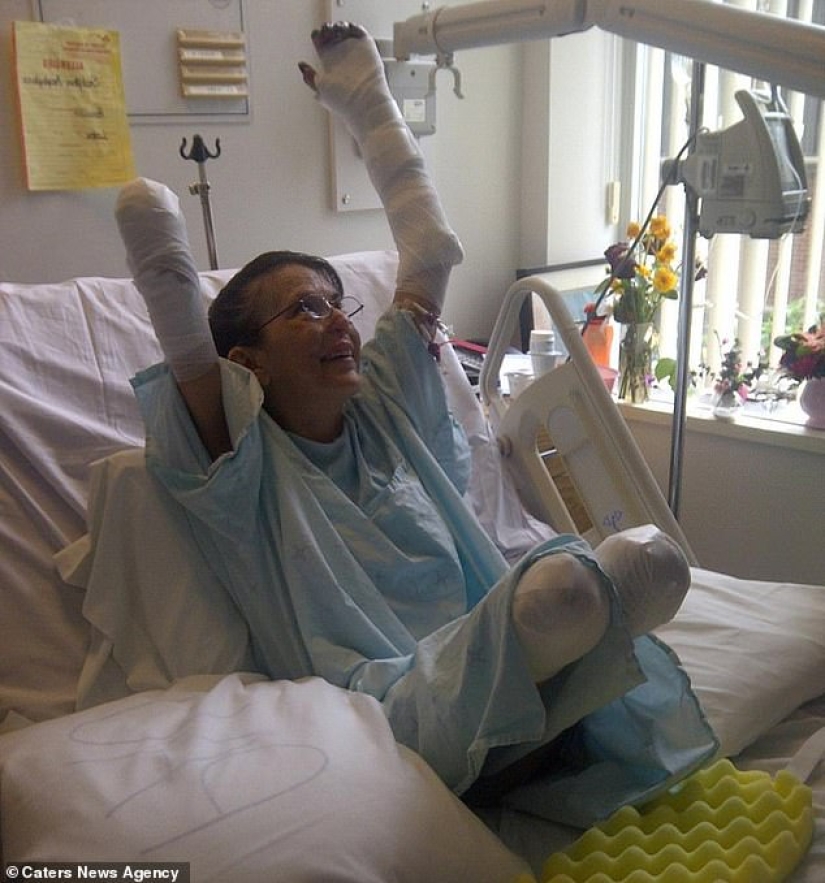 A game with a sad ending: a woman fell ill with sepsis and underwent three amputations after being bitten by her beloved dog A game with a sad ending: a woman fell ill with sepsis and underwent three amputations after being bitten by her beloved dog