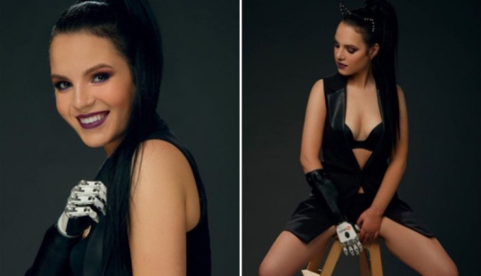 A girl whose husband cut off her hand because of jealousy starred in an erotic photo shoot