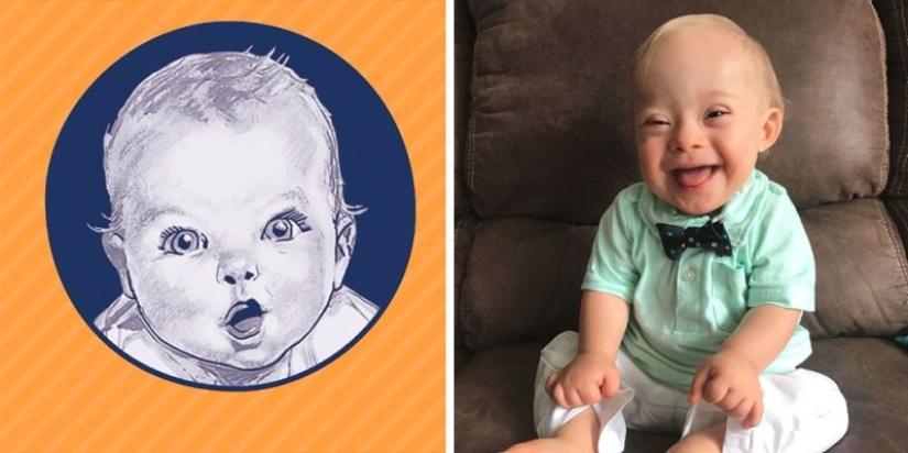 A kid with Down syndrome conquered Gerber with his smile and became the face of a baby food company