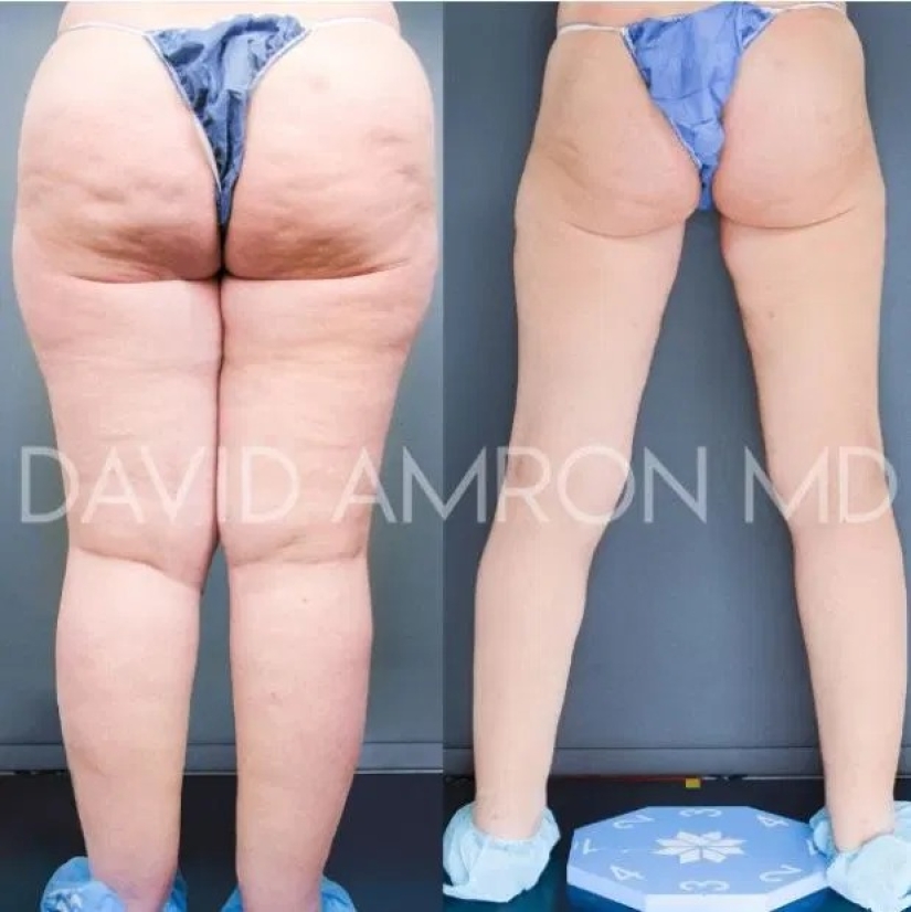 A la guitarrista se le ofreció tratamiento gratuito, pero duda si aceptar ayuda