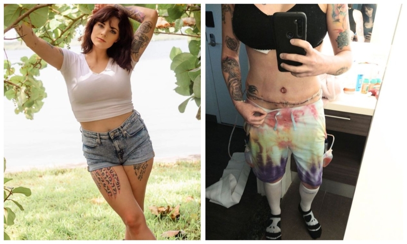 A la mujer americana le agrandaron los senos, la levantaron y le hincharon los labios en lugar de reducir su busto