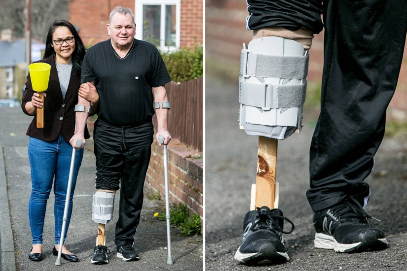A new leg with her own hands: a woman made a prosthesis for her husband from improvised materials