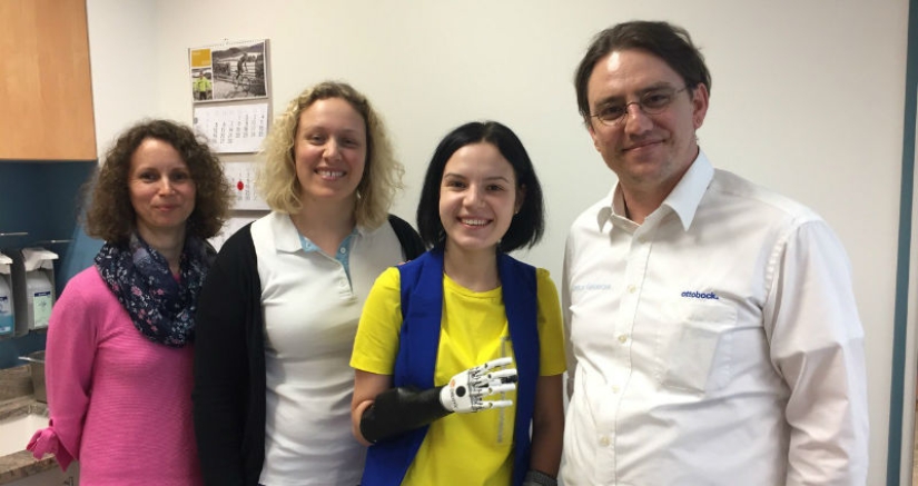 A Russian woman, whose husband cut off her hands out of jealousy, had a bionic prosthesis made A Russian woman, whose husband cut off her hands out of jealousy, had a bionic prosthesis made