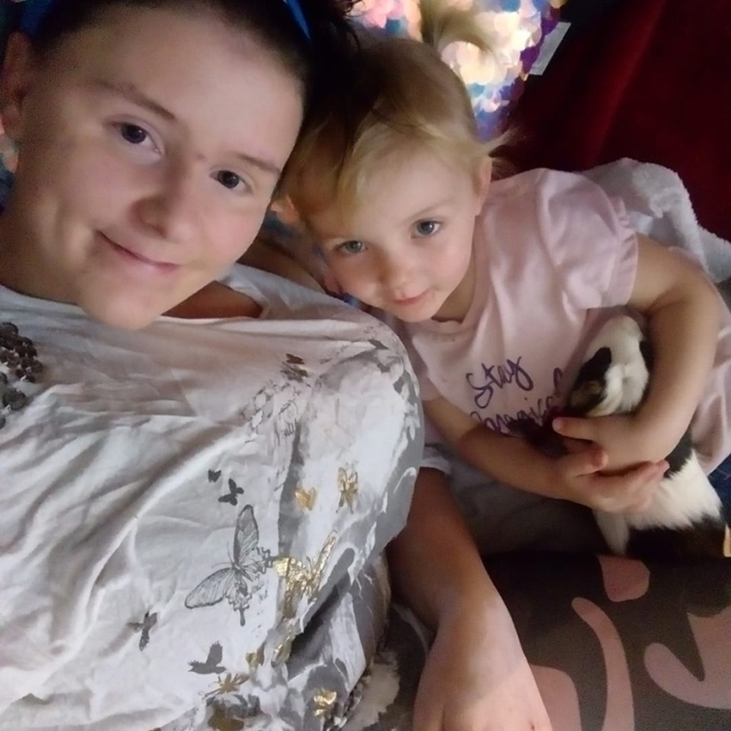 A woman with a 13th breast size told about her suffering