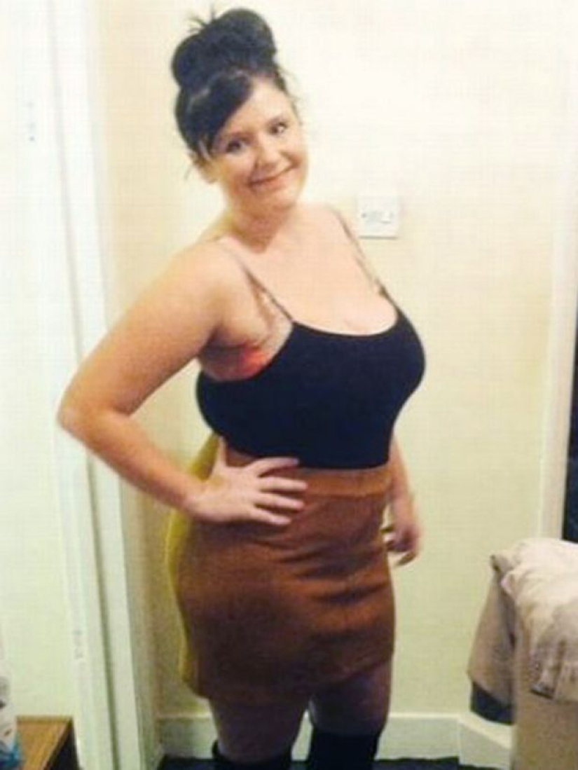 A woman with a 13th breast size told about her suffering