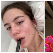 A young American woman almost became disabled due to vaping