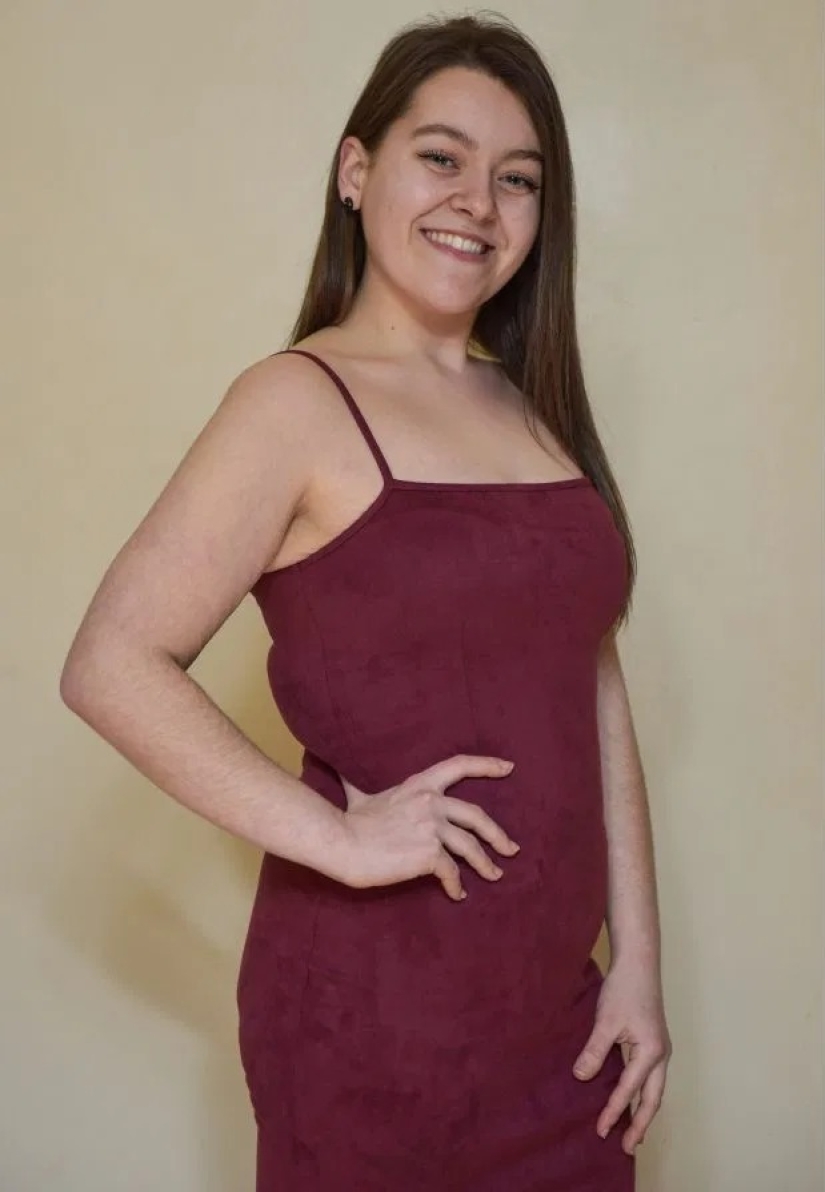 Accidental weight loss: a girl dropped 57 kg while walking a dog